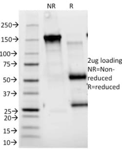 CD25/IL-2R alpha Antibody (143-13), Novus Biologicals:Antibodies:Primary